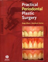 Practical Periodontal Plastic Surgery