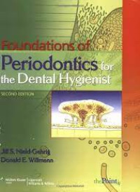 Foundations of Periodontics for the Dental Hygienist