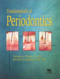 Fundamentals of Periodontics