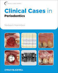 Clinical Caces in Periodontics