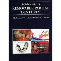 A Colour Atlas of Removable Partial Dentures