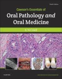 Cawson's Essentials of Oral Pathology and Oral Medicine