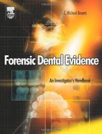 Forensic Dental Evidence An Investigator's Handbook