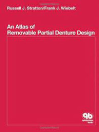 An Atlas  of Removable Partial Denture Design