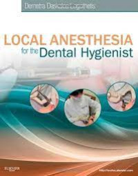 Local Anesthesia for the Dental Hygienist