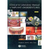 Clinical & Laboratory Manual of Implant Overdentures