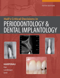 Hall's Critical Decisions in Periodontology & Dental Implantology