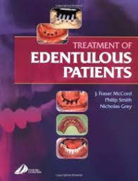 Treatmen of Edentulous Patients