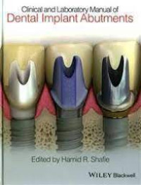 Clinical and Laboratory Manual of Dental Implant Abutments