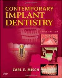 Contemporary Implant Dentistry