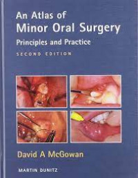 An Atlas of Minor Oral Surgery Principles and Practice