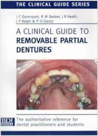 A Clinical Guide to Removable Partial Dentures