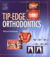 Tip-Edge Orthodontics