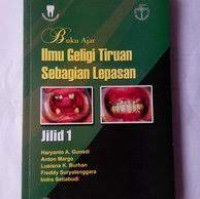 Buku Ajar Ilmu Geligi Tiruan Sebagian Lepasan