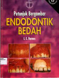 Petunjuk Endodontik Bedah