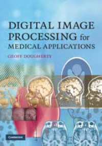 Digital Image Processing for Medical Applicattions